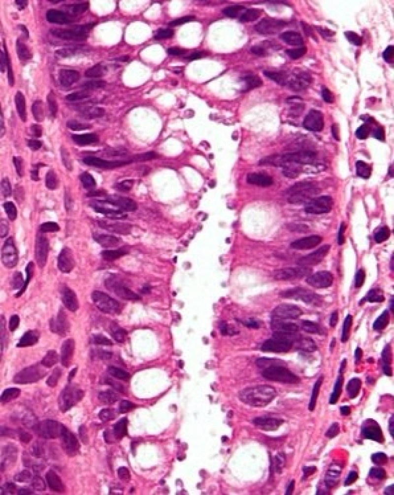 CRYPTOSPORIDIUM İNAKTİVASYONU